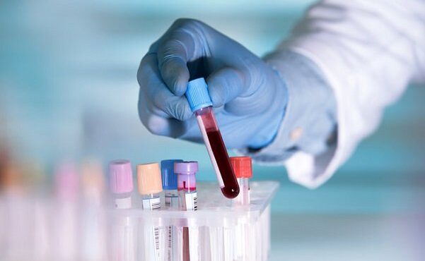 خطر HPV کاملا جدی است؛ نگرانی یک ویروس شناس